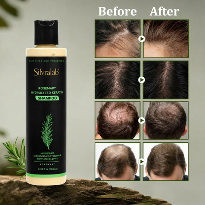 🔥LAST DAY 50% OFF - Silvralab Organic Rosemary Hair Growth Shampoo