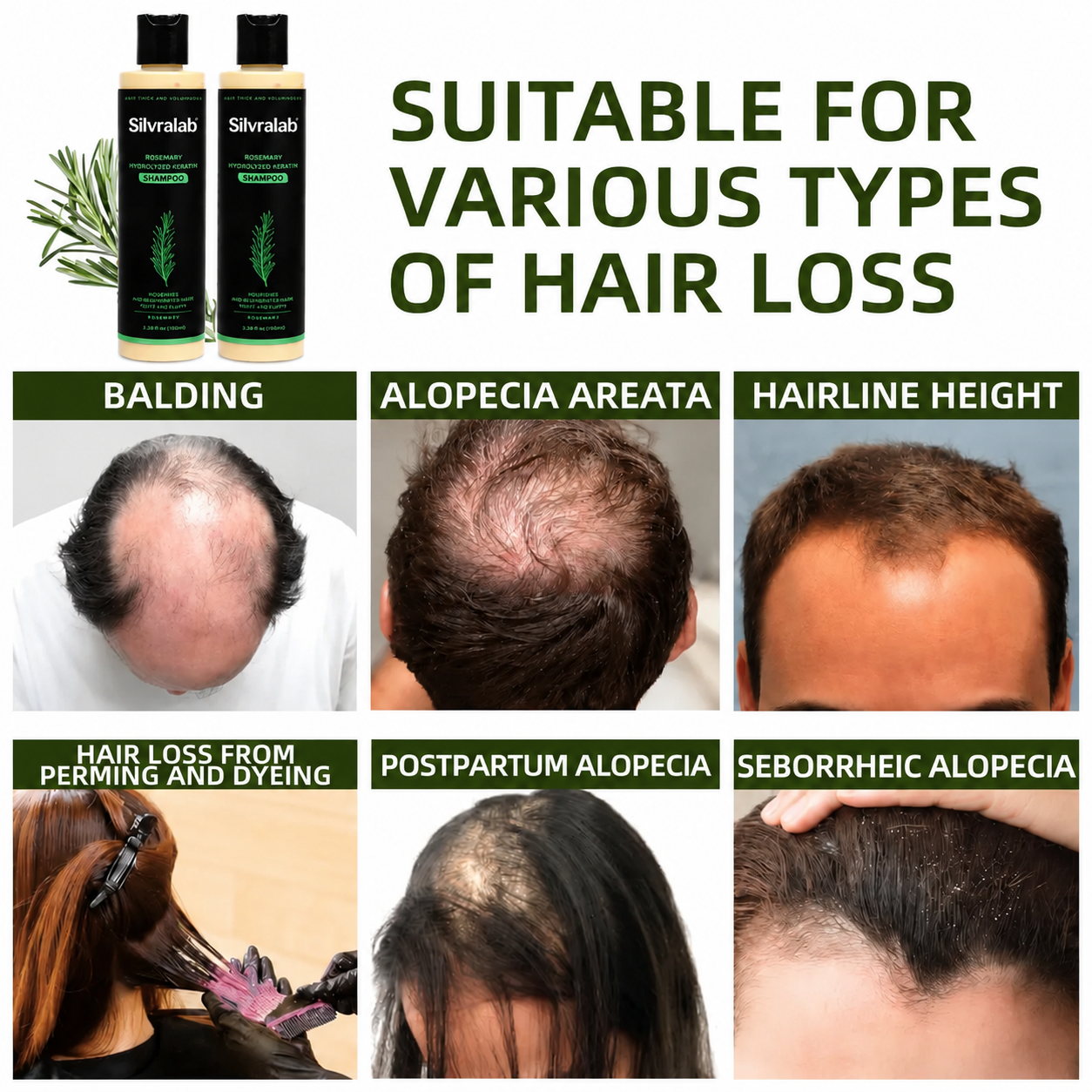 🔥LAST DAY 50% OFF - Silvralab Organic Rosemary Hair Growth Shampoo